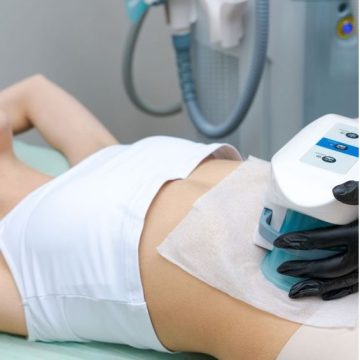 CoolSculpting
