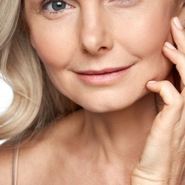 Fine-Lines-and-Wrinkles